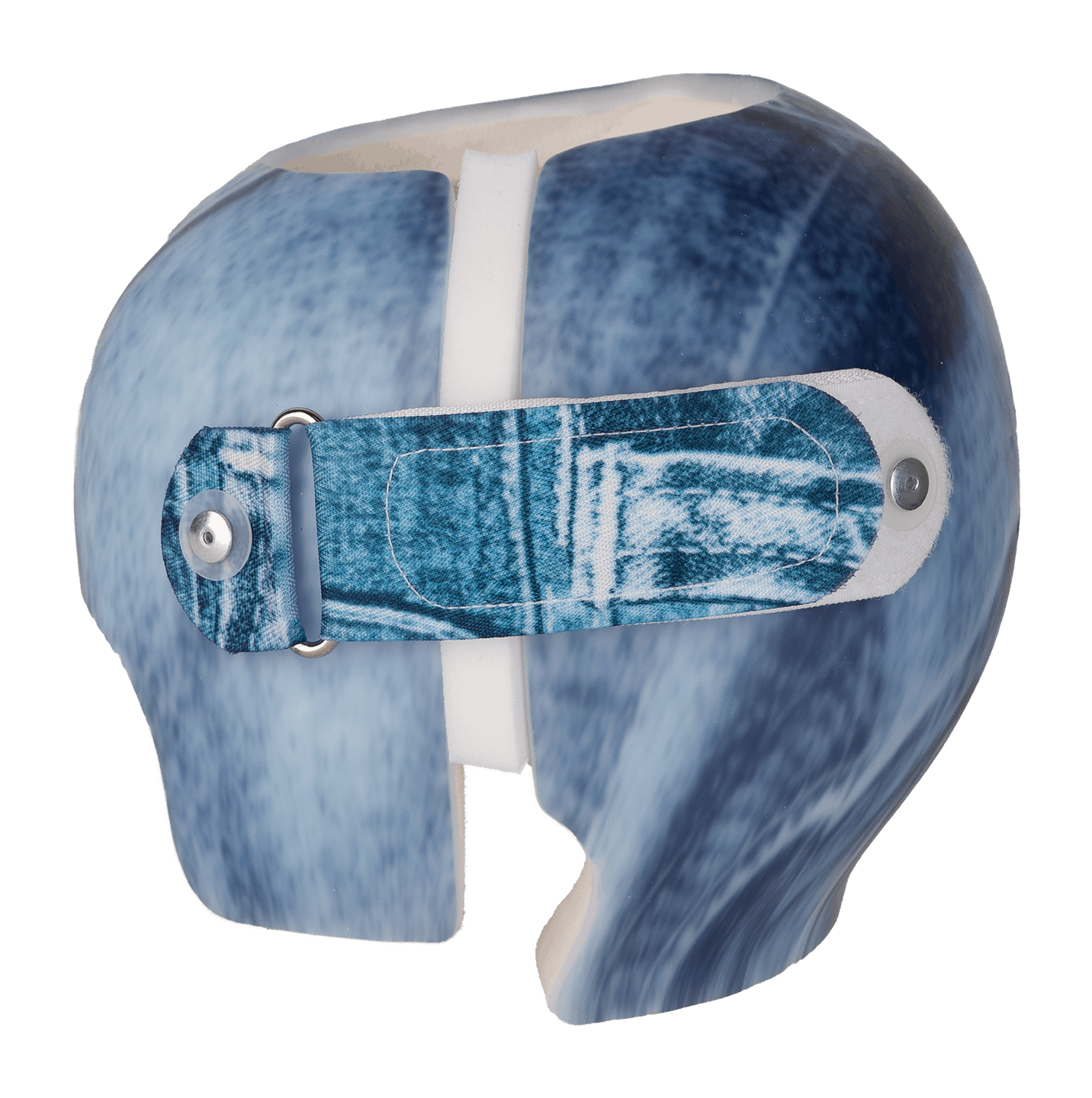 Remodelación craneal